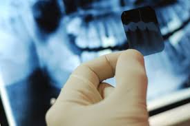 Radiologia Odontoiatrica